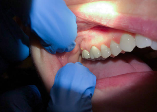 Best Weekend Emergency Dentist in East End, AR