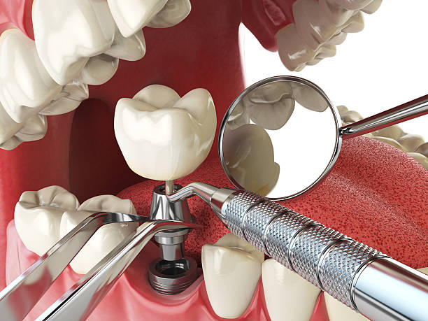 Best Emergency Tooth Extraction in East End, AR